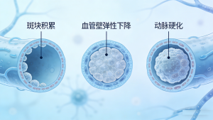 警惕！血管“变硬”悄无声息，这些信号别忽视｜社区健康科普