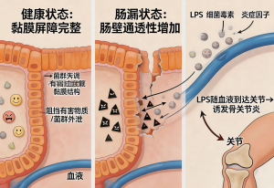 肠道菌群失调为何会引发骨关节炎？藏在肠胃里的关节健康密码